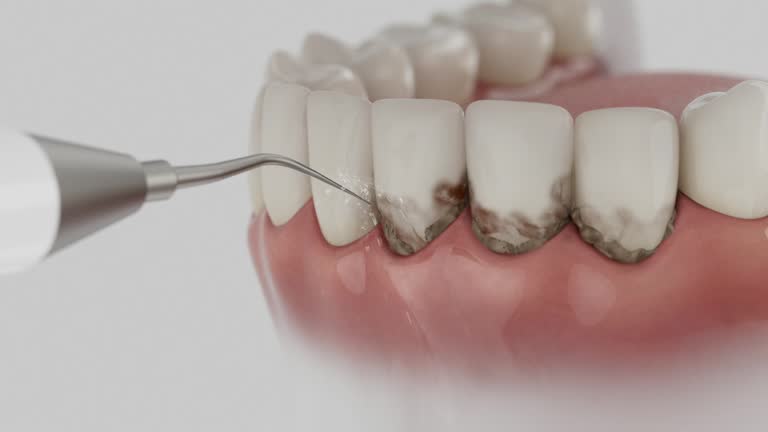 Trusted Tooth Extraction service in Horseshoe Bay, TX - Dentist Open Now
